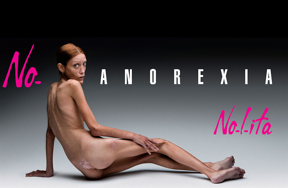 飽受厭食症摧殘多年的法國模特兒Isabelle Caro，圖為2007年她拍攝的反厭食症廣告。